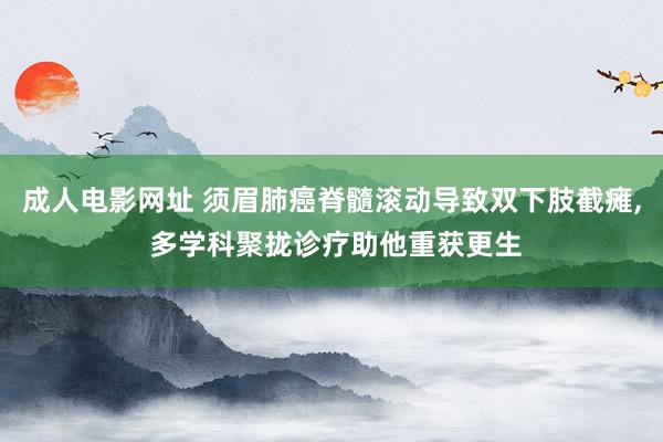 成人电影网址 须眉肺癌脊髓滚动导致双下肢截瘫, 多学科聚拢诊疗助他重获更生